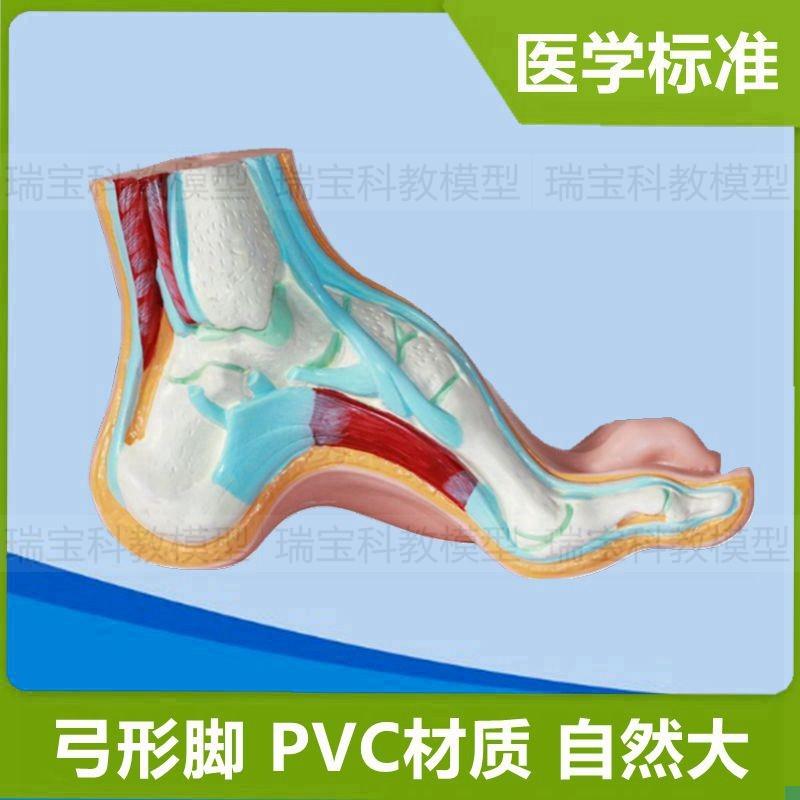 弓形足模型脚部畸形平足畸形爪形足高弓足人体T脚骨仿真1:1