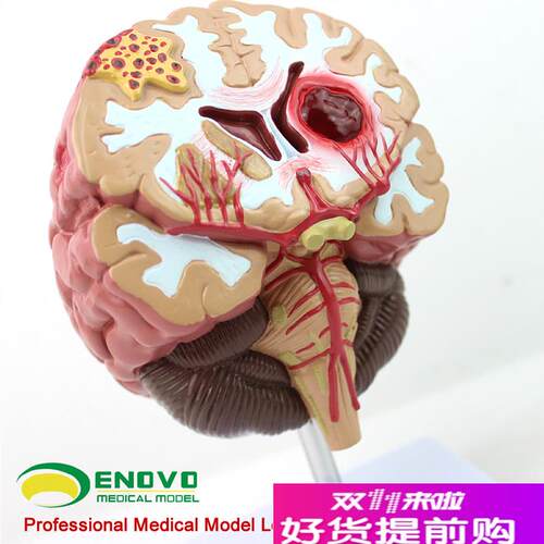 颐诺正品医用人体脑部疾u病模型大脑模型神经外科神经内科模型