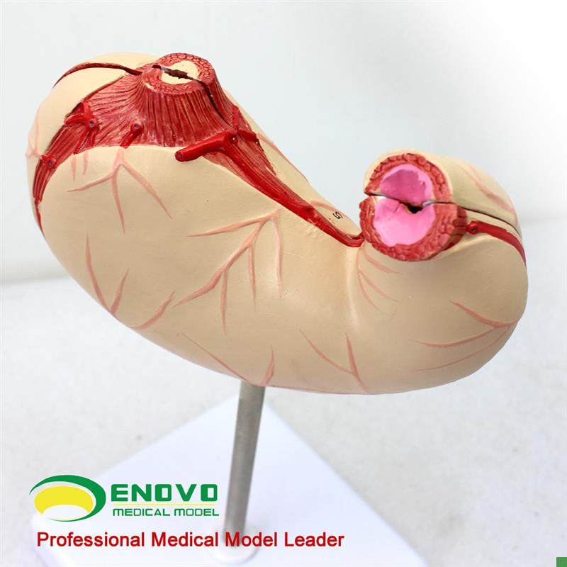 颐诺正品胃解剖结构模型胃模z型人体消化系统器官医用解剖模型