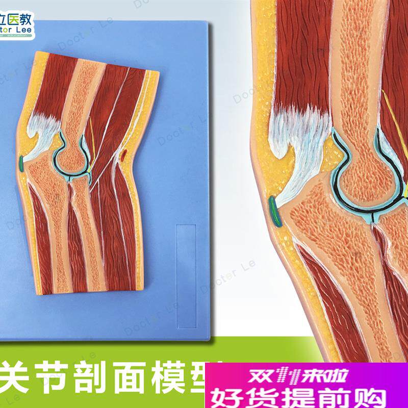 人体断层扫描肘i关节切面浮雕手肘关节断层解剖学模型ct运动解剖