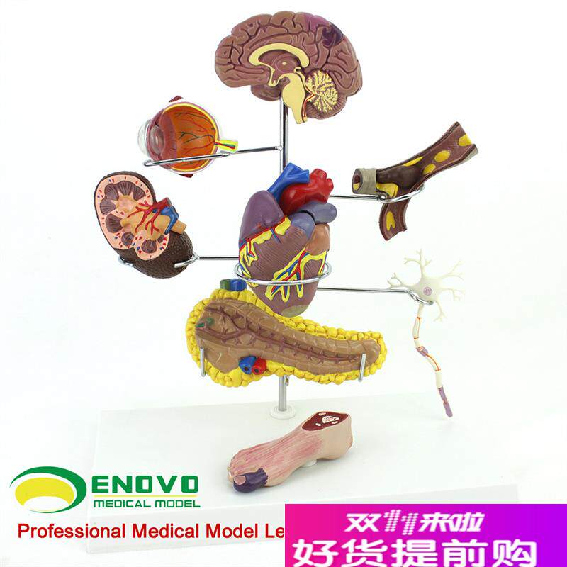 ENOVO颐诺人体医学糖t尿病模型并发症大脑心脏胰腺神经元足内外科