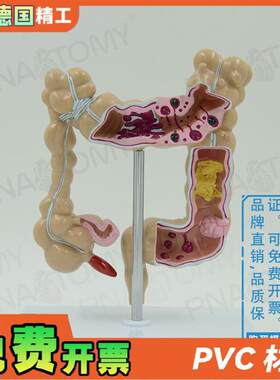 德国】仿真人体结肠大肠解剖模型肛肠科肠道肠胃消Z化系统教学