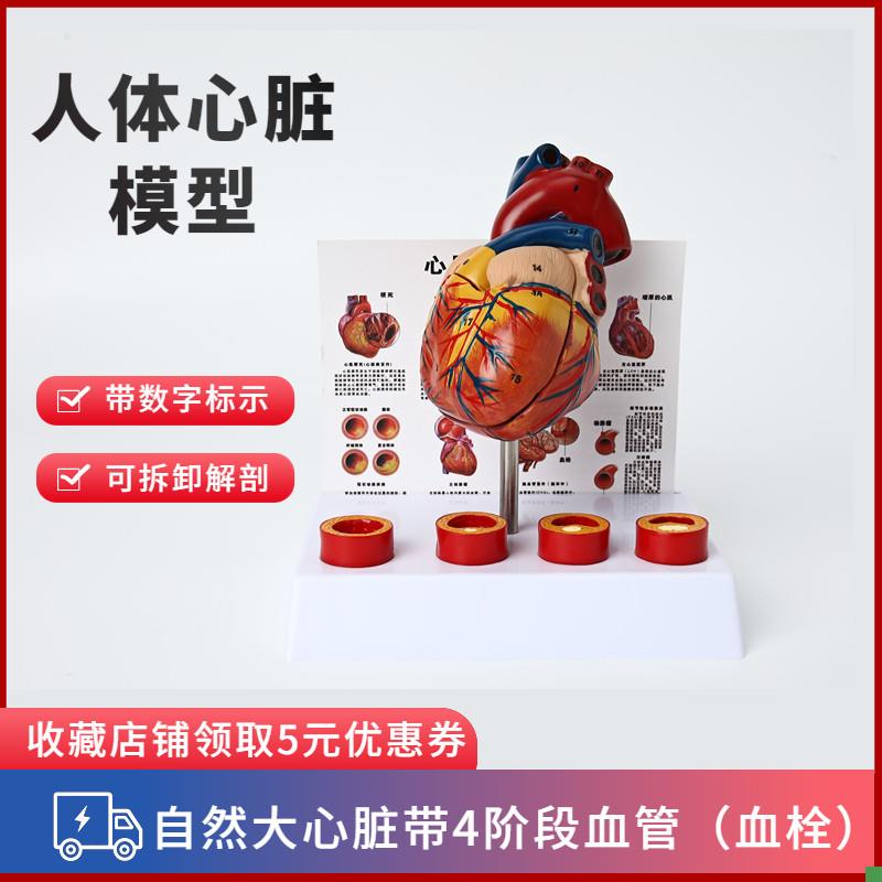人体心脏模型四阶段血栓可拆卸冠状动脉心N血管血液循环解剖器官