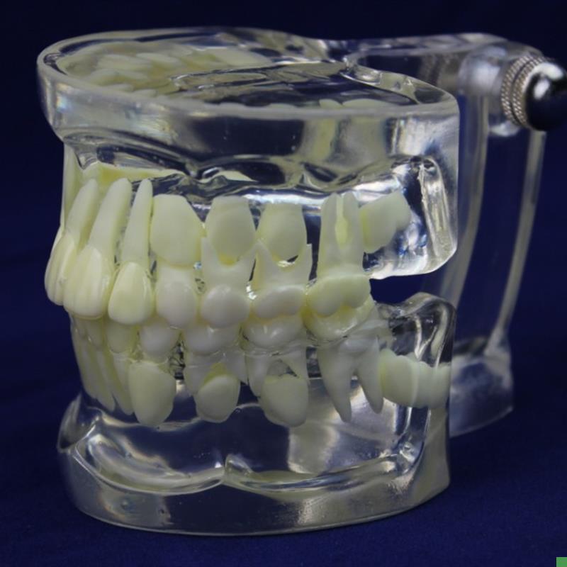 ENOVO颐g诺全透明乳恒牙交替模型儿童牙齿列发育指导刷牙模型