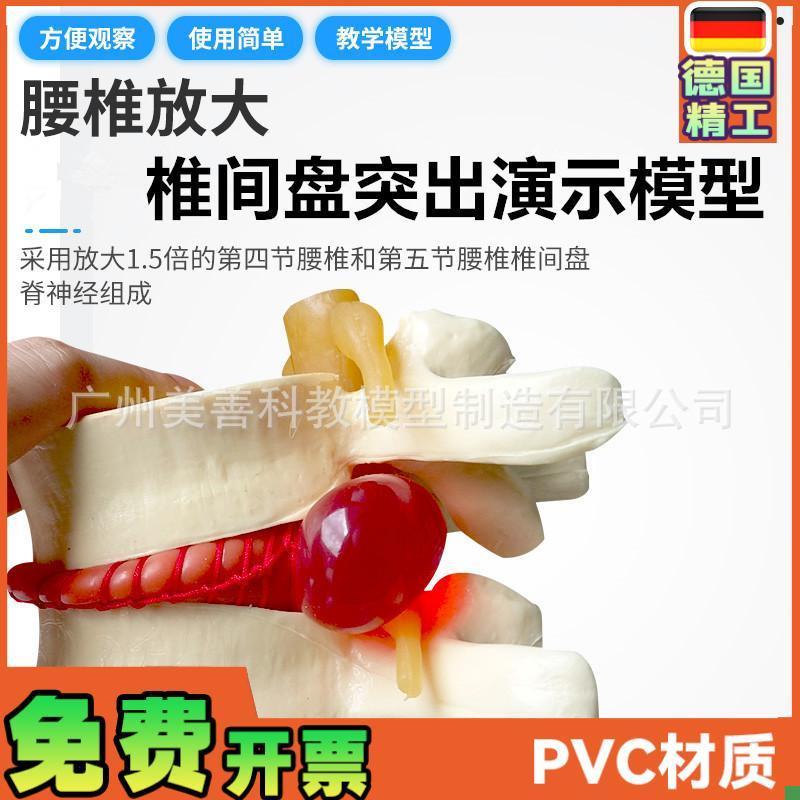 椎间盘模型正品医学人体腰椎突出C脊柱脊椎骨病理演示关节标准模