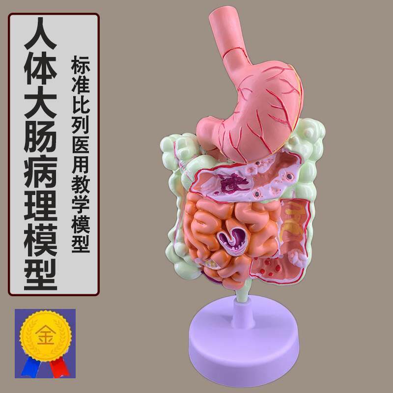 人体消化系统解剖模型大肠模型直肠十二指肠内脏肠胃解剖构造模型