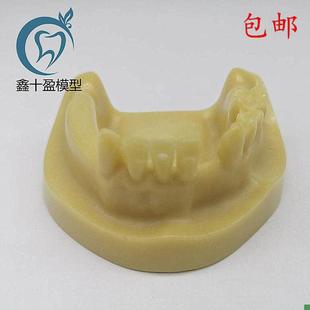 牙科材料下半口种植练习模型发泡缺失种植练习教学V模型M2028