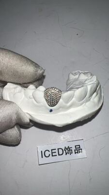 ICED莫桑牙套满钻嘻哈风格钻牙定制单颗满钻镶嵌莫桑钻