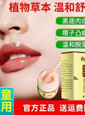 【官方正品】草本配方点痣膏点黑点黑痣肉痣凸痣痦子去除