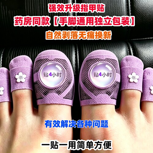 【香港断货王】指甲贴正品专用贴植物萃取脚趾手指甲专用
