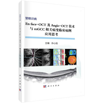 正版书籍 En face-OCT及Angio-OCT技术与mGCC相关病变临床病例应用思考孙心铨医学眼科学9787030583192科学出版社