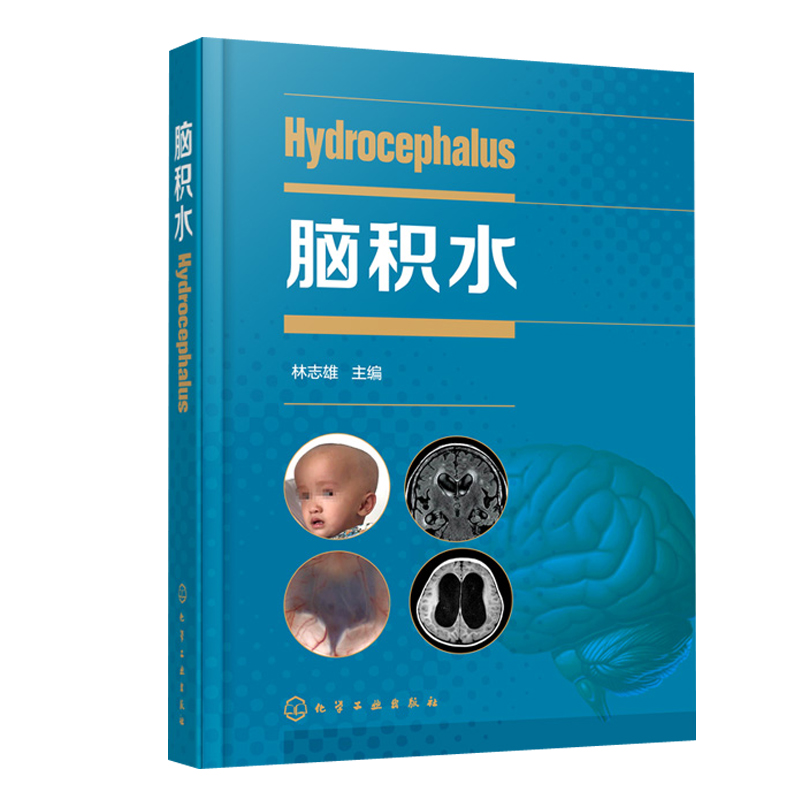 正版书籍 脑积水 林志雄主编脑手术技巧周良辅赵继宗王忠诚神经外科颅底手术入路显微外科神经内镜神经外科学脑血管脑外科颅脑损伤