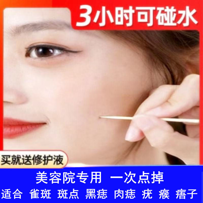 点痣药水祛斑药水祛黑痣膏修复液去雀斑黑点脸部去丝状疣美容仪