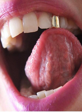 hiphop grillz金牙套嘻哈饰品单颗牙齿镶金边嘻哈牙套镂空金牙套