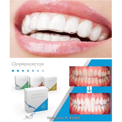 定制Opalescence美国皓齿美白牙套牙托盘美白剂过氧化脲凝胶