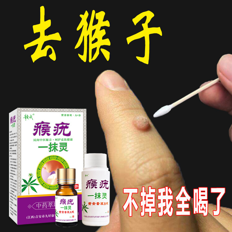 去猴子肉粒疙瘩脖子去瘊子神器刺猴去除正品手部鱼鳞痣点猴子疙瘩