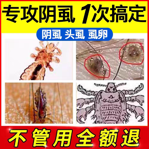 百部酊去阴虱药男士用女私处虱子药一扫光除虱卵喷剂虱立净灭虱灵