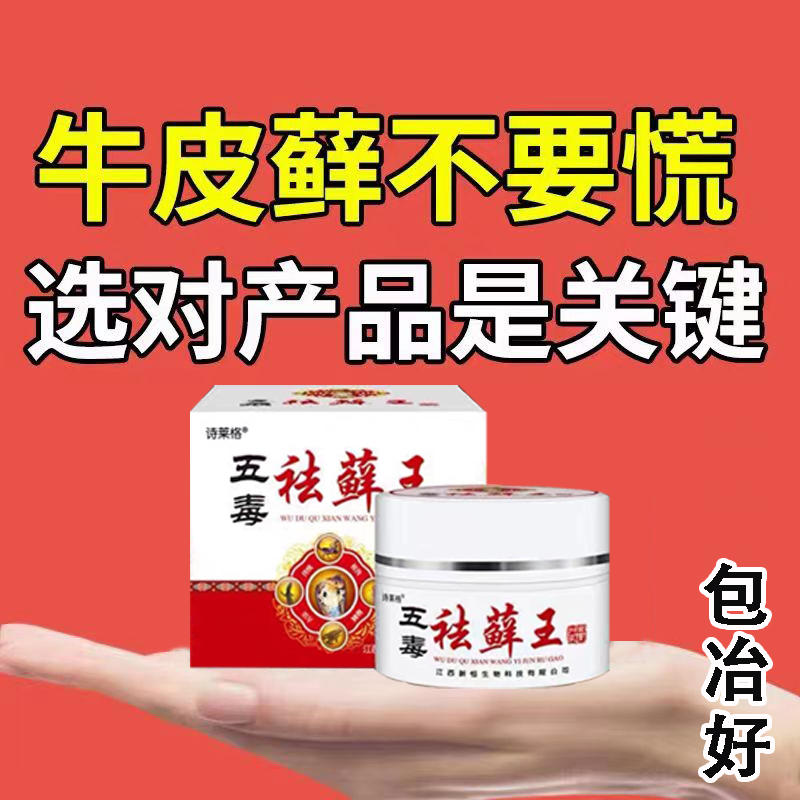 苗家治牛皮廯藓癣银屑病膏湿疹根去止痒头股体手足癣专用药膏