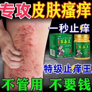 苗药百毒王外用身上骚痒过敏皮肤紫花地丁止痒草本抑菌膏