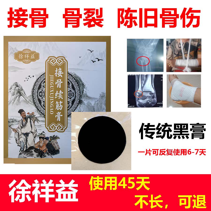 徐祥益接骨续筋膏骨断接骨膏骨裂恢复扭伤韧带拉伤筋伤骨伤黑膏贴