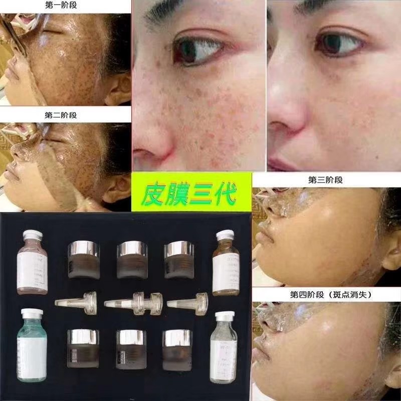 美容院净颜术三代皮膜涂抹面部修护嫩白祛斑提亮肤色去黄淡化痘印在类目 美容护肤/美体/精油, 面膜（新）, 面膜粉中 - 来自Buy2taobao.com提供专业的淘宝代购服务