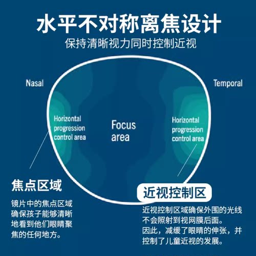 罗敦司得防控离焦镜片迈控