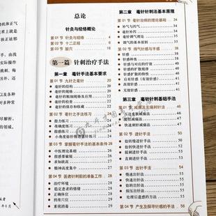 (正版)图解针灸大全/中医经络穴位书针炙学全书入门刺血疗法全一针疗法马氏温灸法黄帝内针灸绳基本功大成甲乙经针灸秘验与绝招