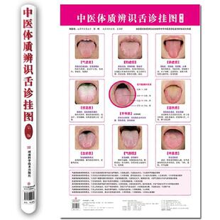 （正版）中医体质辨识舌诊挂图第2版 梁嵘 中医望舌诊病气虚质/阳虚质/阴虚质/痰湿质/湿热质/血瘀质/气郁质/特禀质舌象健康管理要