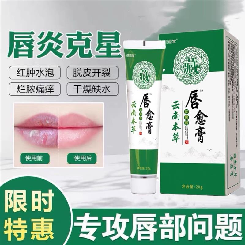 云南本草唇愈膏嘴唇干裂脱皮起泡烂嘴角消肿修复去死皮唇炎润唇膏