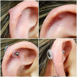 食品级10片防增生硅胶内陷小飞碟