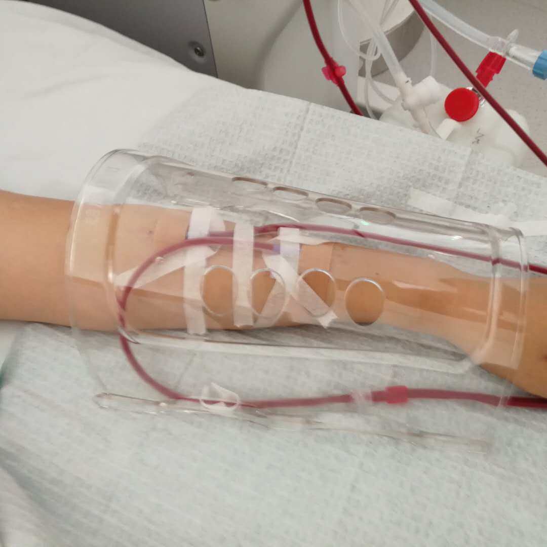 朗腾血液透析胳膊内瘘专用保护罩 防护罩 防止挤压移动 内瘘罩