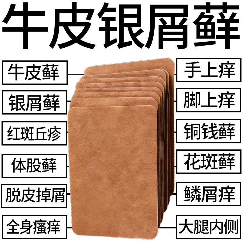 顽固牛皮藓专用膏贴成人银屑病胳膊肘膝盖身上痒起红疙瘩干燥破裂,洗护清洁剂/卫生巾/纸/香薰,足贴,淘宝优惠券,粉丝福利购,淘宝优惠卷