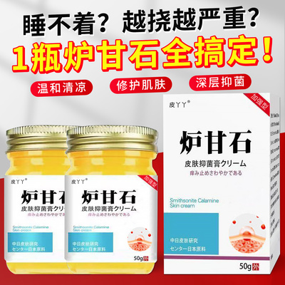 正品止痒王抑菌乳膏皮肤瘙痒疹湿止痒软膏大腿内外用炉甘石止痒膏