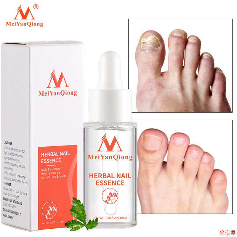 Beauty Beauty Herbal Armor essence MYQ006 草本护甲精华液
