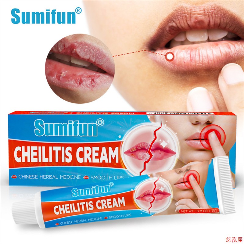 3PCS Sumifun CHEILITIS CREAM  HERBAL MEDICNE SMOOTH LIPS