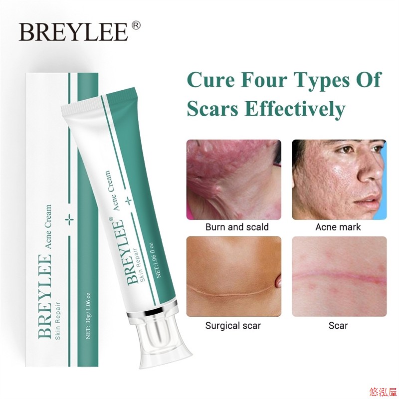 BREYLEE Remove scars Pregnant woman Stretch marks Care cream