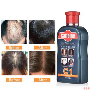 Caffeine Shampoo Slow Down Hair Loss Stimulate Hair Growth