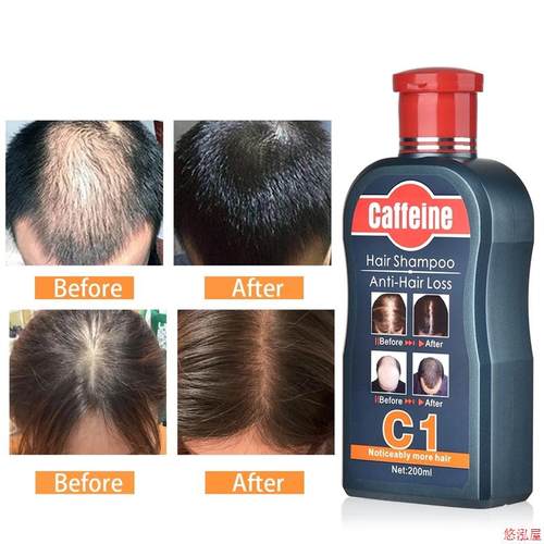 Caffeine Shampoo Slow Down Hair Loss Stimulate Hair Growth