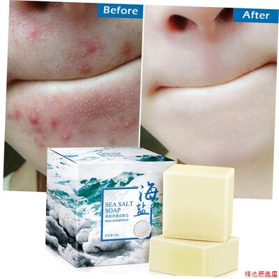 Sea Salt Soap Cleaner Removal Pimple Pores Acne海盐除螨香皂