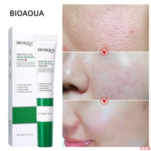 20G Salicylic Acid Acne Removal Cream Shrink Pores Refining