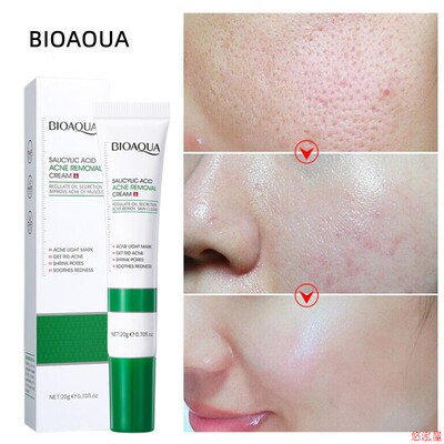 20G Salicylic Acid Acne Removal Cream Shrink Pores Refining