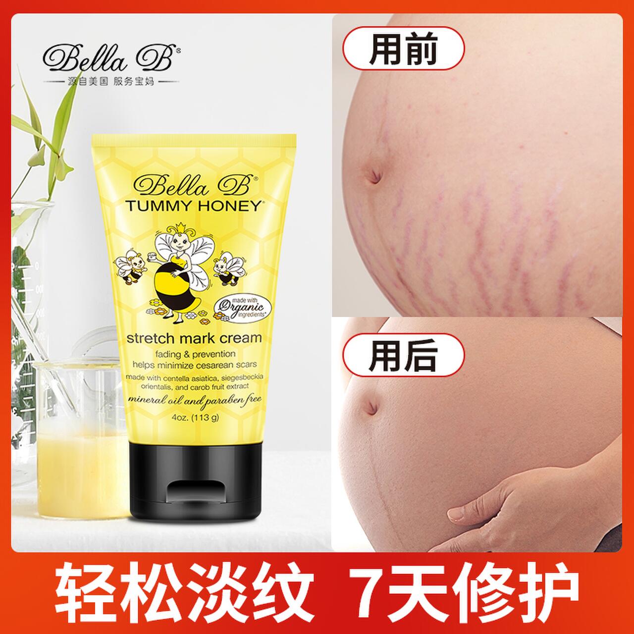 小蜜蜂孕妇肥胖纹妊娠纹修复霜妊娠纹产后消除妊辰纹淡化妊娠纹