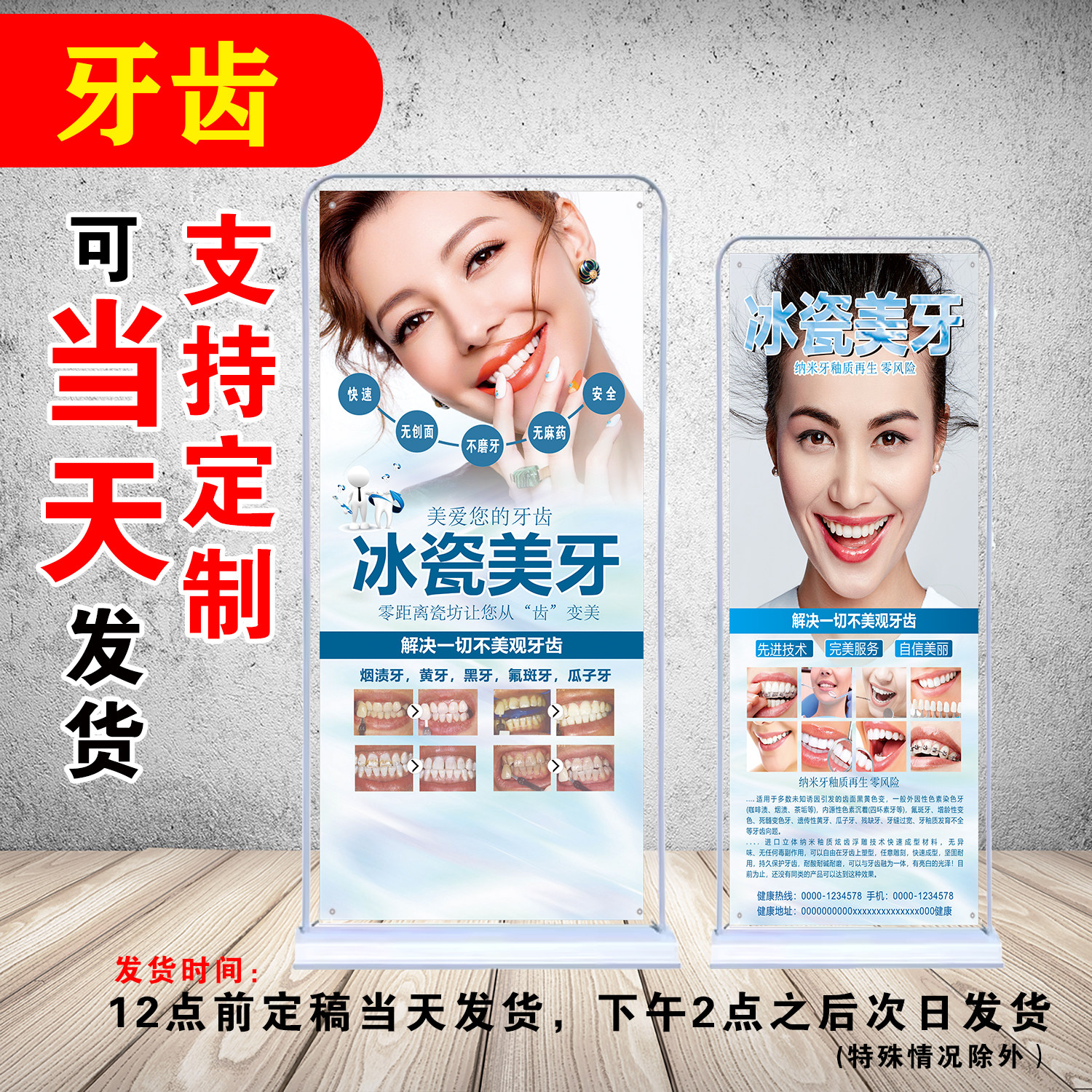 美白牙齿冰瓷超薄贴面美牙高清户外易拉宝防水注水展架定制海报