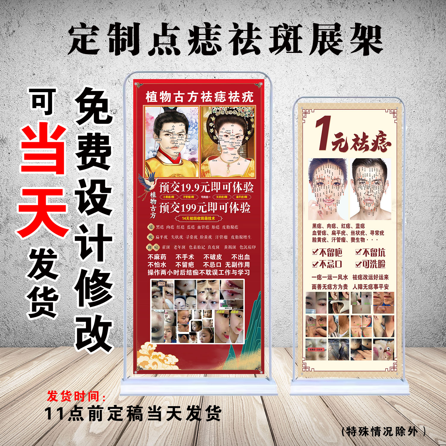 点痣祛痣祛斑祛疣易拉宝门型展架