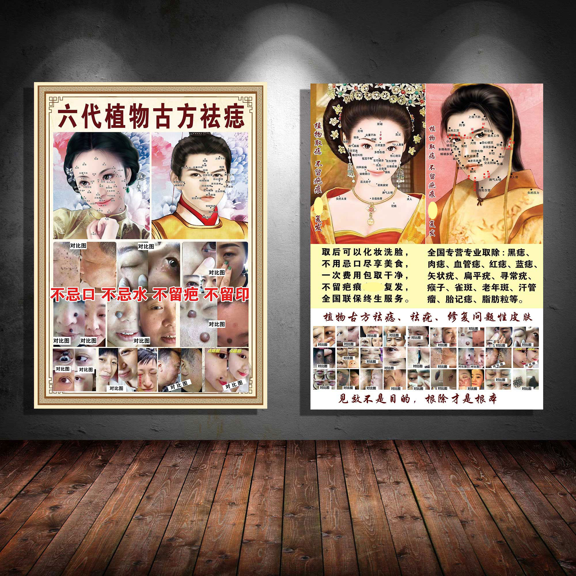 面痣图点痣疣斑定制广告