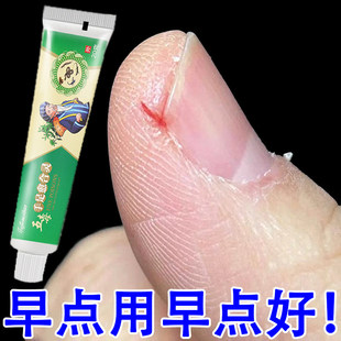 手指头裂口子干裂修复霜秋冬季指甲缝开裂脱皮防愈合膏