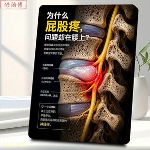 科普相框摆台医院骨科屁股疼病因医学解剖装饰摆件