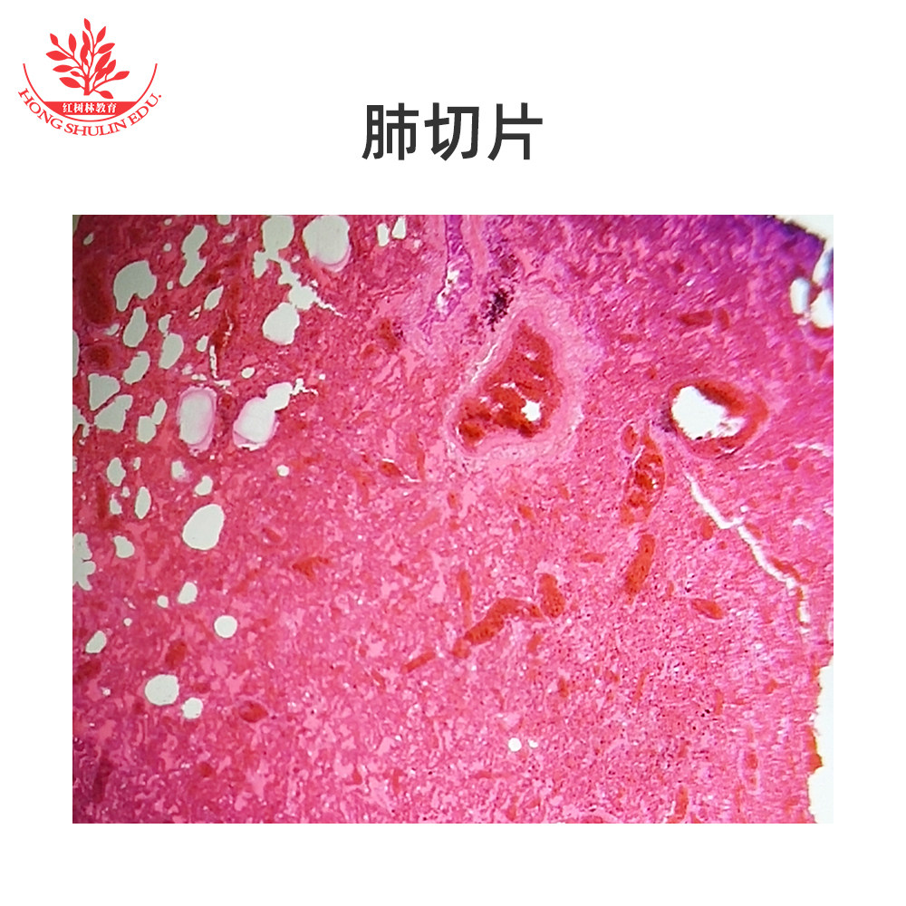 心脏切片肾纵切肺切片