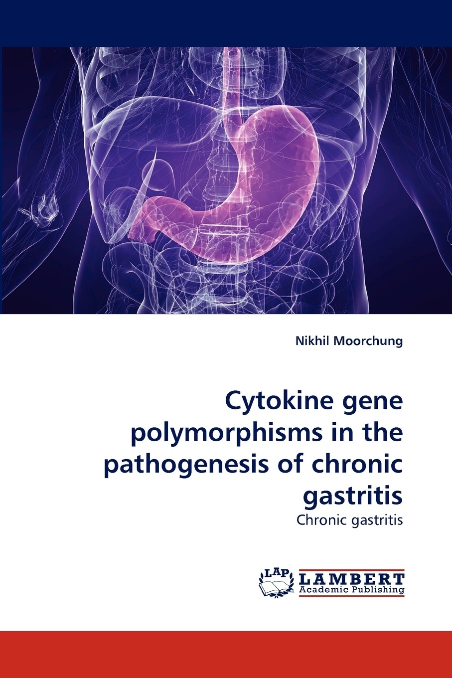 【预售 按需印刷】cytokine gene polymorphisms in the pathogenesis