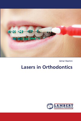 预售 按需印刷 Lasers in Orthodontics